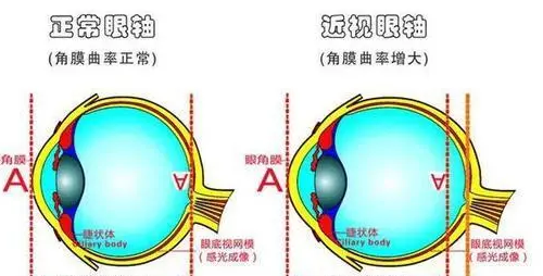 正常情况下，大部分学龄前儿童的视力，会出现什么情况